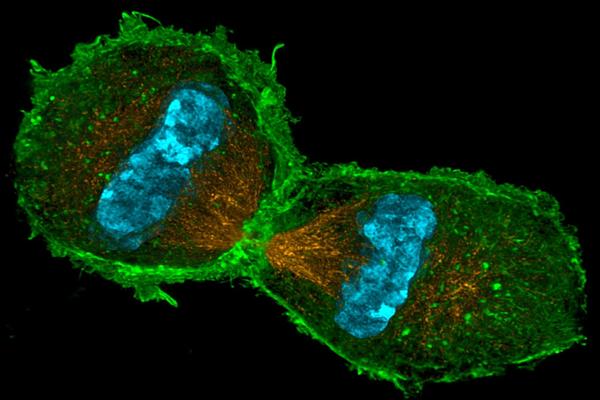 dividing cell