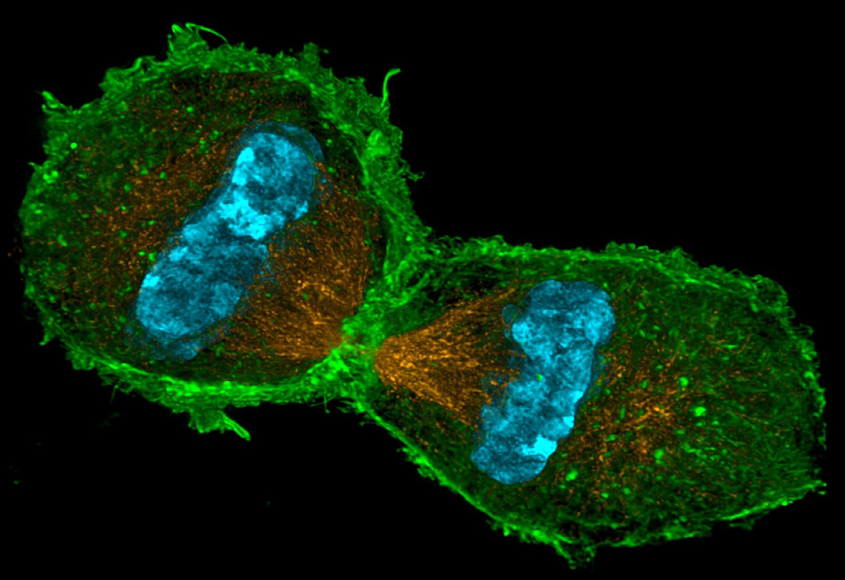 dividing cell